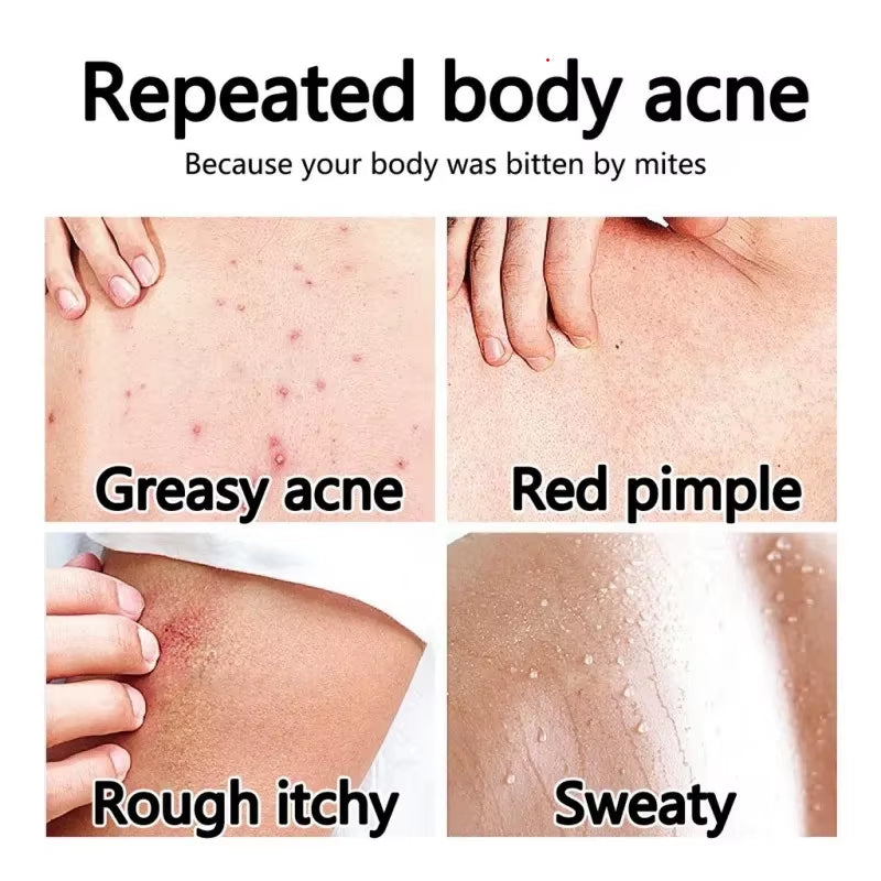 Vaseline Niacinamide Body Lotion Relieves Dry and Dehydrated Skin Exfoliates and Brightens Skin Tone Hydrating Body Lotion 400Ml