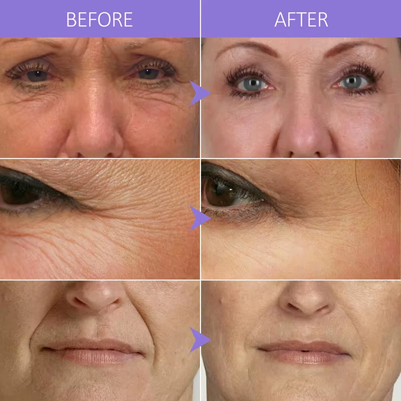 Retinol Anti-Wrinkle Face Serum Collagen Anti-Aging Hyaluronic Acid Whitening Bakuchiol Serum Facial Skin Care 40Ml